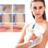 Lescolton T011c Ice Cooling IPL Hair Removal Device