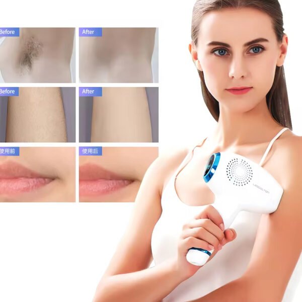 Lescolton T011c Ice Cooling IPL Hair Removal Device