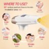 Lescolton T009i IPL Hair Removal Device