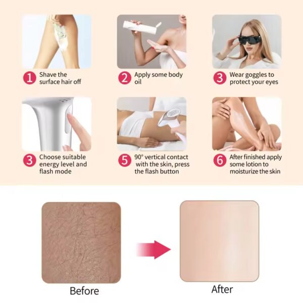 Lescolton T009i IPL Hair Removal Device